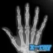 X-Ray Scanner